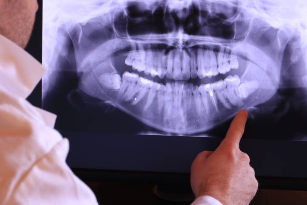 Best Emergency Dentist for Knocked-Out Tooth in Fort Riley, KS